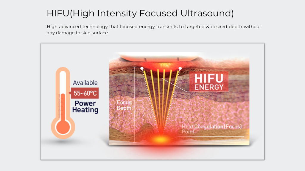 Ultra Vera HIFU