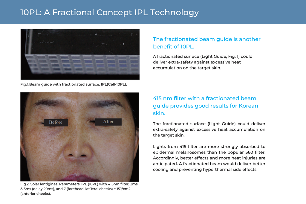 10PL Fractional IPL