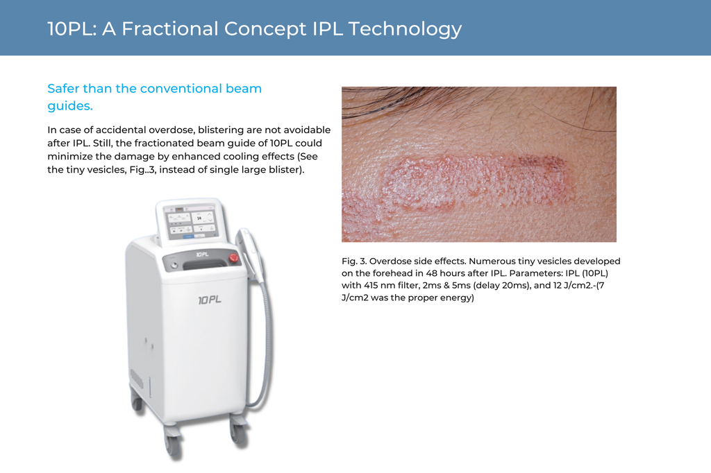 10PL Fractional IPL