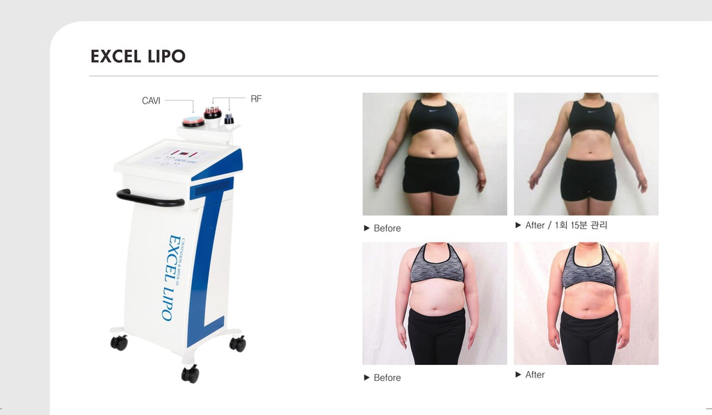 Excel Lipo